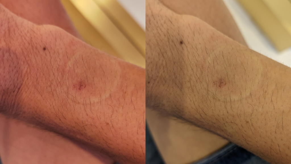 iwo w69 ultra iwo w69 é bom